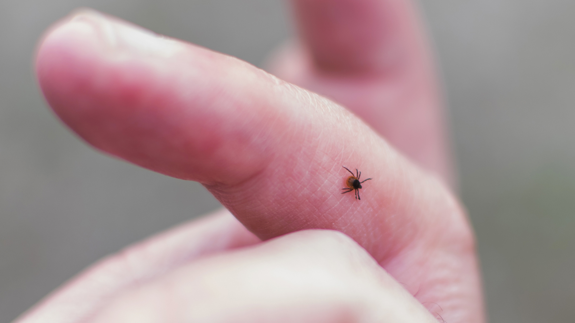 How Long Should You Use an Infrared Sauna for Lyme Disease